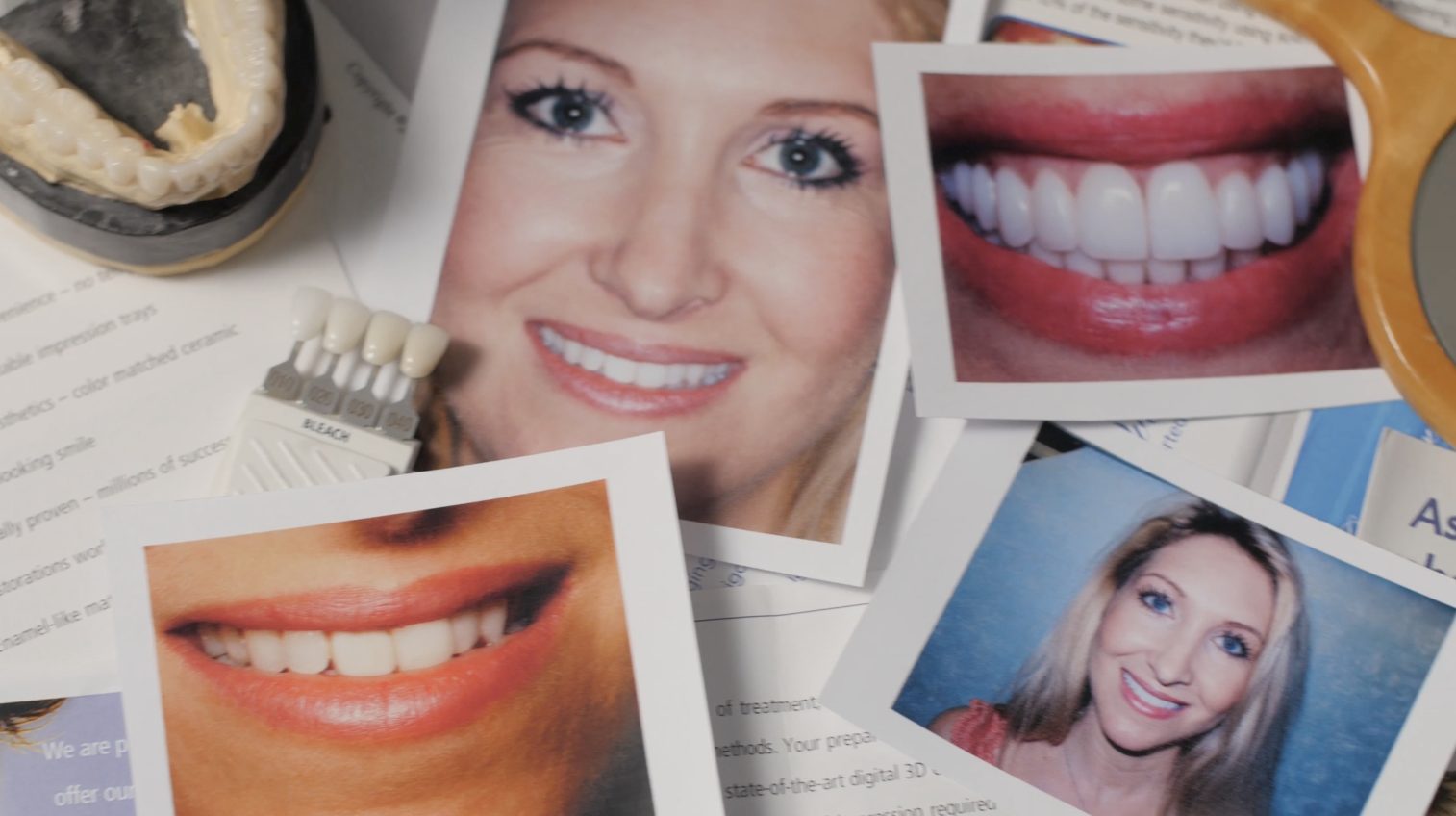 Austin Dental Spa | Stacy Testimonial